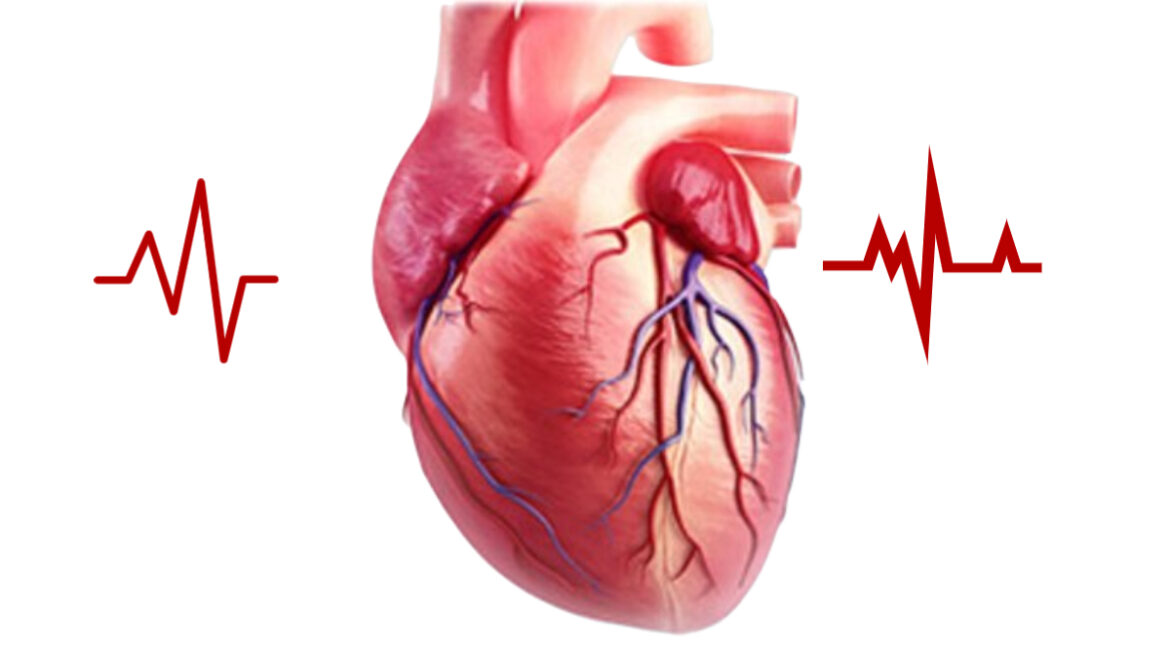 Heart disease- Top 10 Causes of Death in Humans around the World