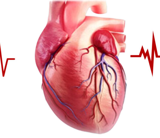 Heart disease- Top 10 Causes of Death in Humans around the World