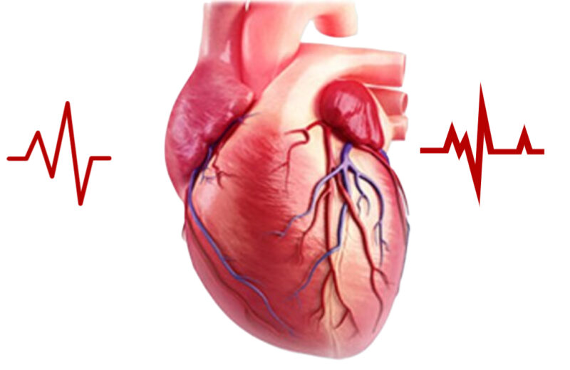 Top 10 Causes of Death in Humans around the World 2023