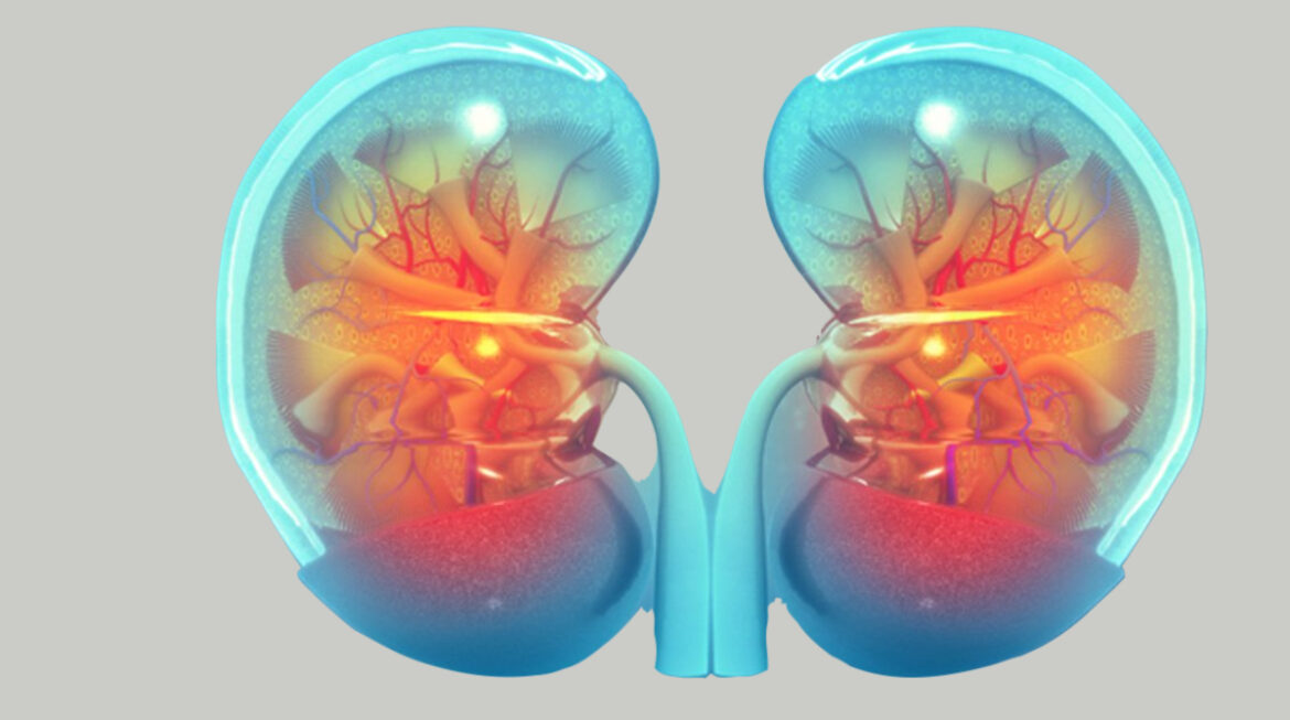 Kidney disease- Top 10 Causes of Death in Humans around the World