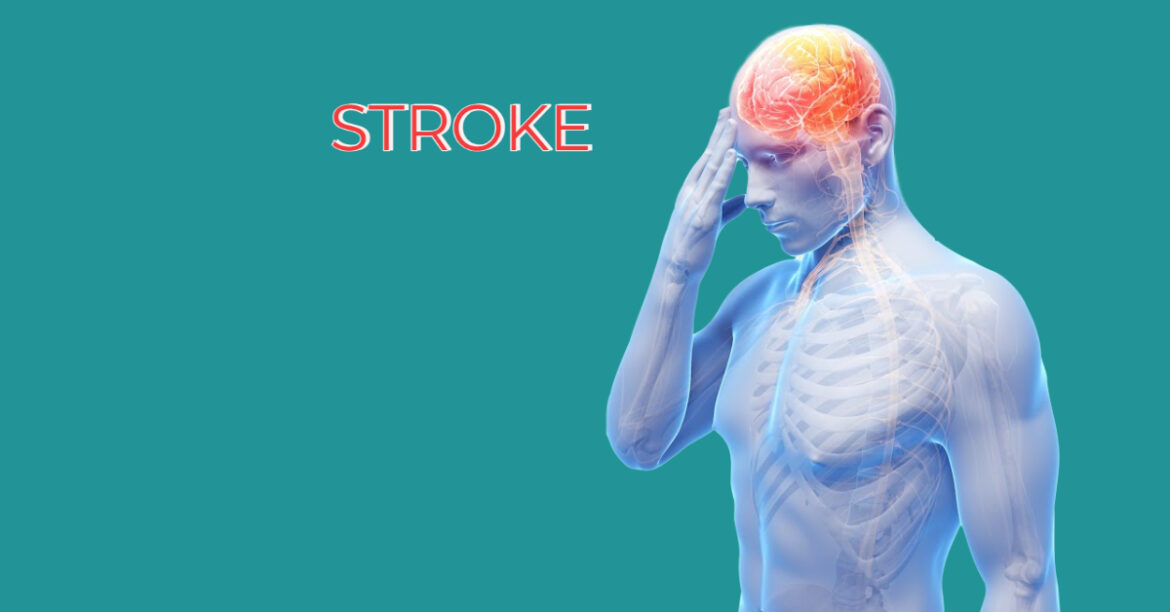 Stroke- Top 10 Causes of Death in Humans around the World